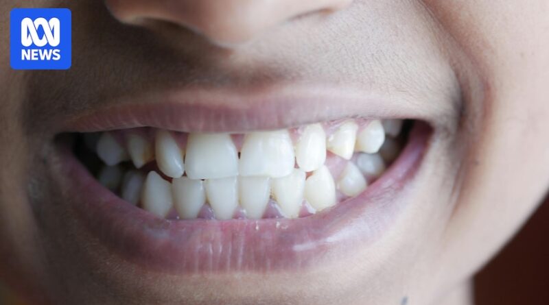 What our teeth reveal about the growing gap between rich and poor