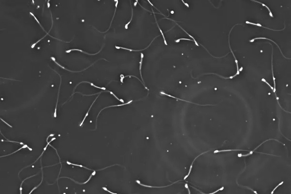 For such a crucial cell, much is unknown about sperm.