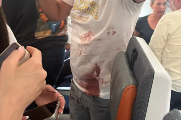 A photo purportedly showing one of the passengers on flydubai FZ1073 with blood on his shirt.